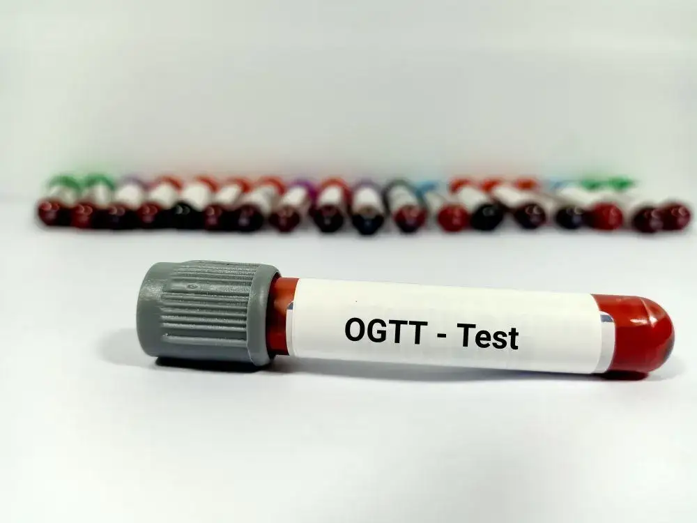 Zdjęcie Krzywa glikemiczna: Jak test może ujawnić ryzyko cukrzycy